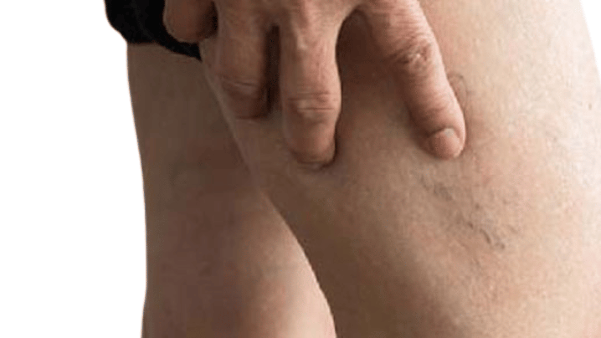A Cautionary Tale About Deep Vein Thrombosis